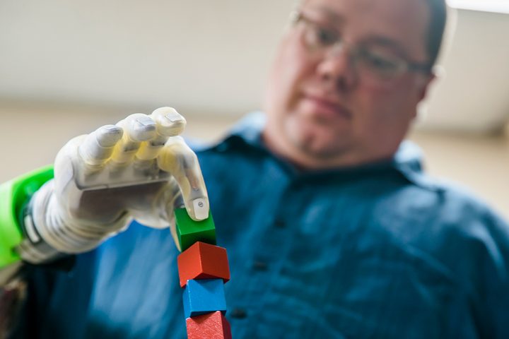 most advanced hand prosthetic