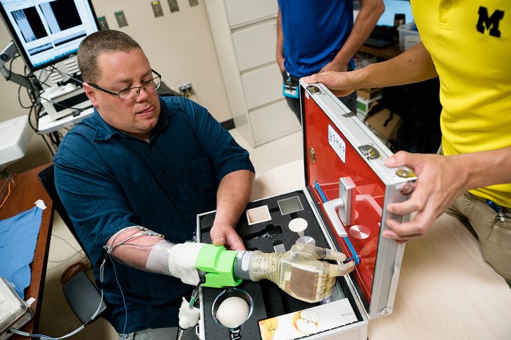 most advanced hand prosthetic