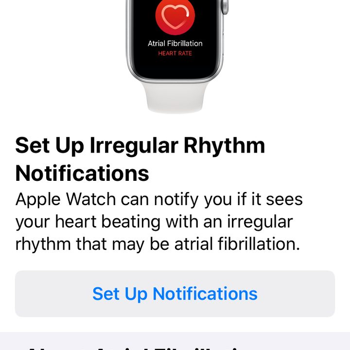 how to use apple watchs fitness features heart77