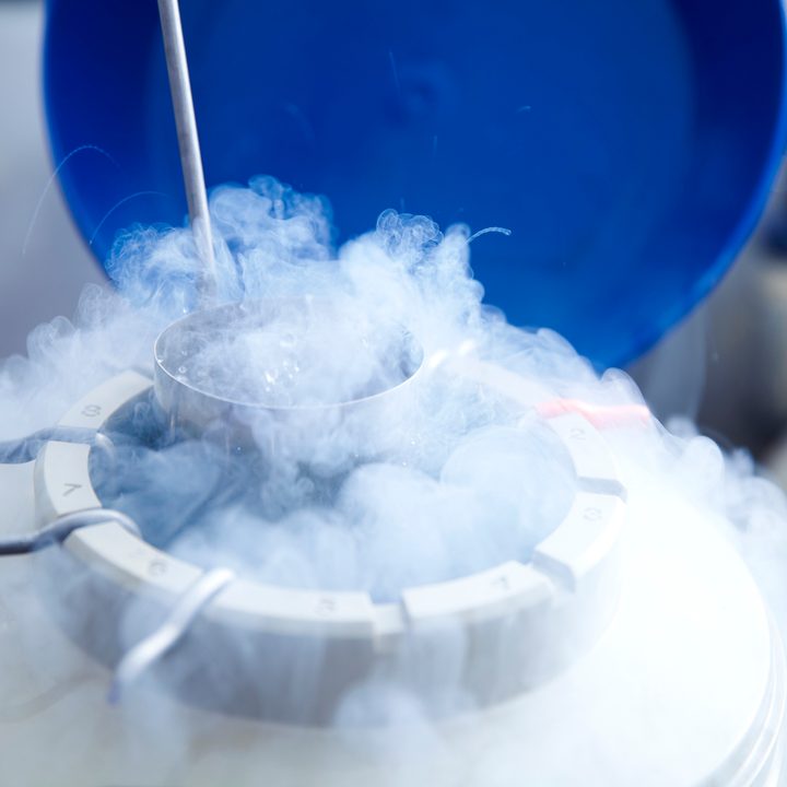 cryonics