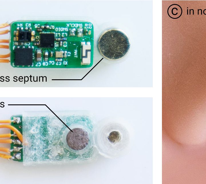 Nose Zapping Wearable Tech