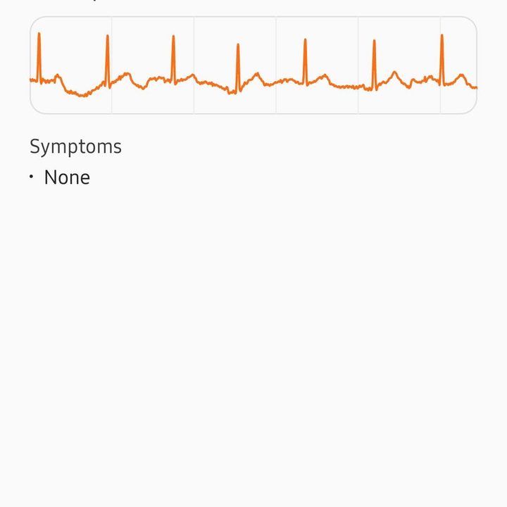 Watch 4 ECG app.