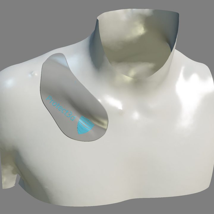 Protect3D's 3D-printed collarbone brace.