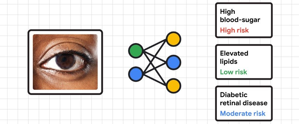 A diagram showing a person's eye outlines Google's plan to test using phone camera to detect health issues.