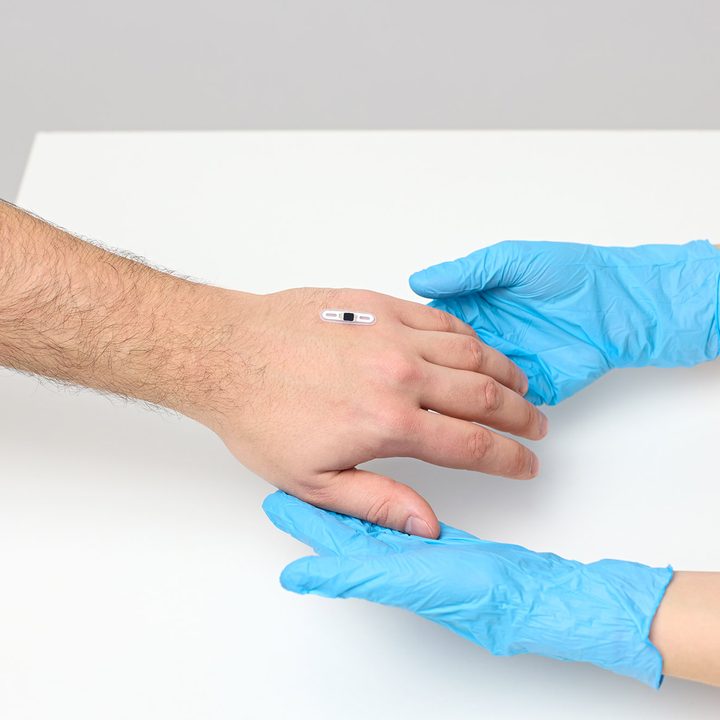 The Walletmor chip arm implant that is used to make payments.