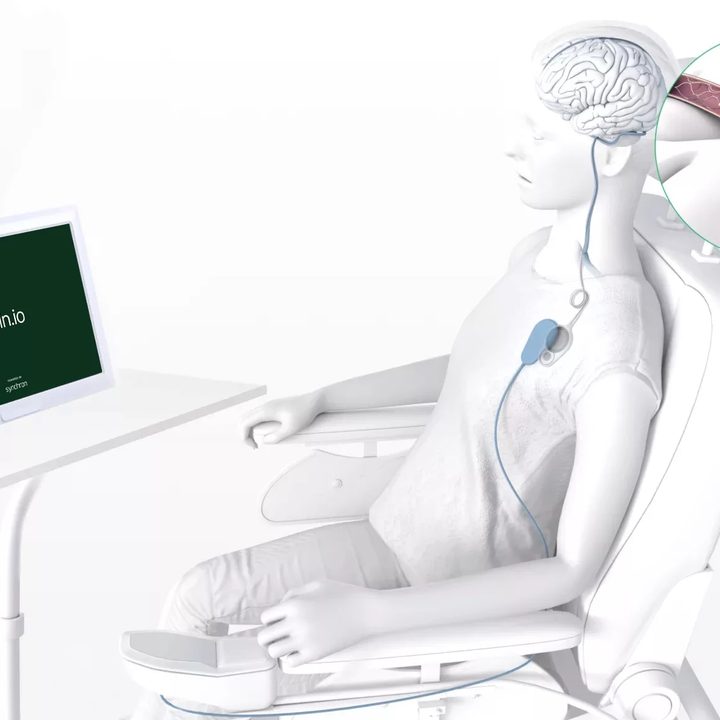 This graphic shows how Synchron's BCI with Stentrode and brain.io neuroprosthesis works.