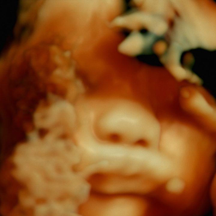 A small human head during a surgical procedural.