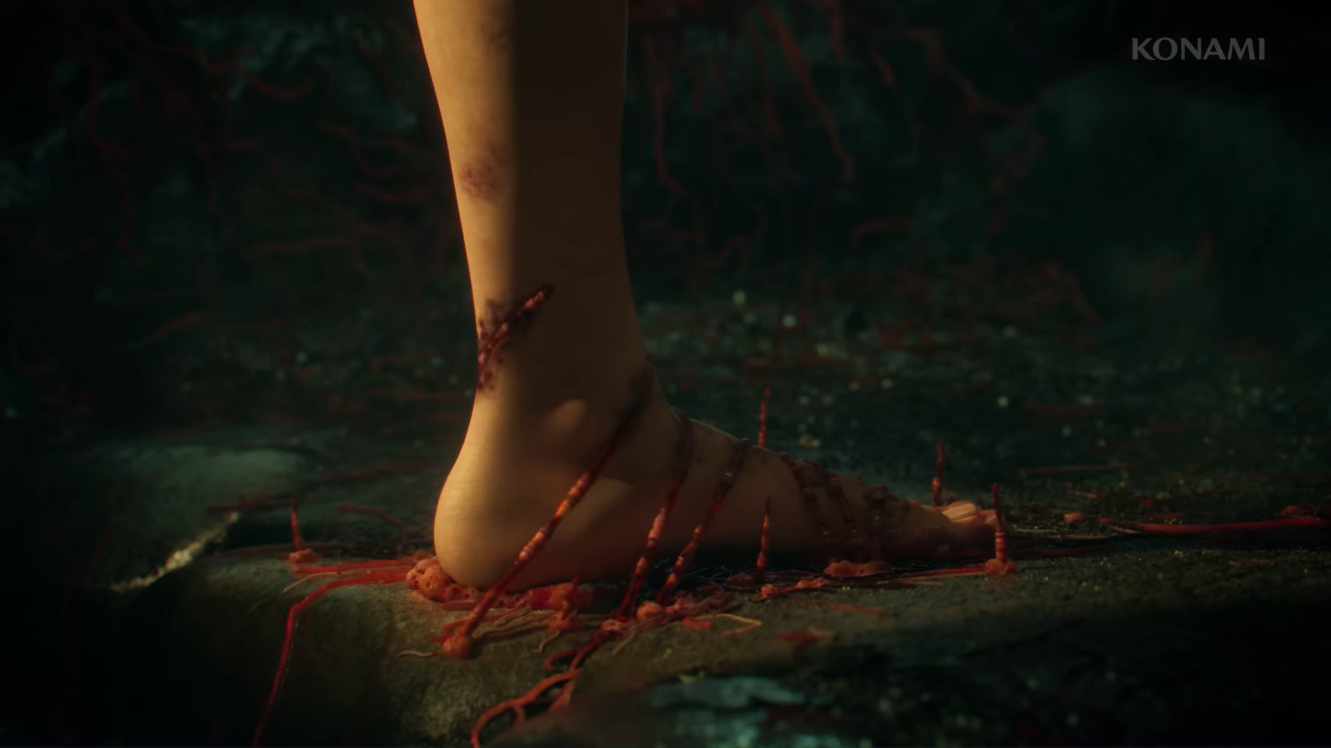 A girl's foot caught in red vines.