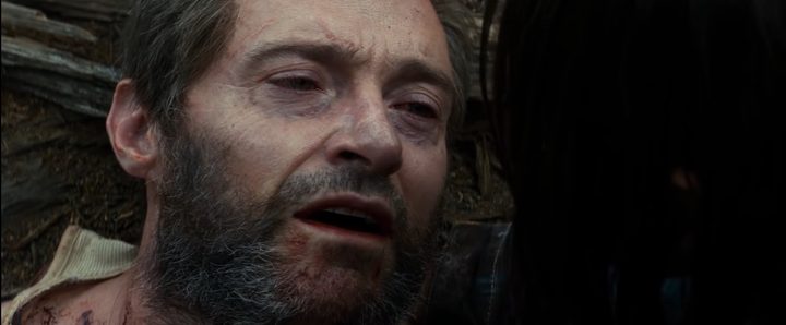 logan-dying
