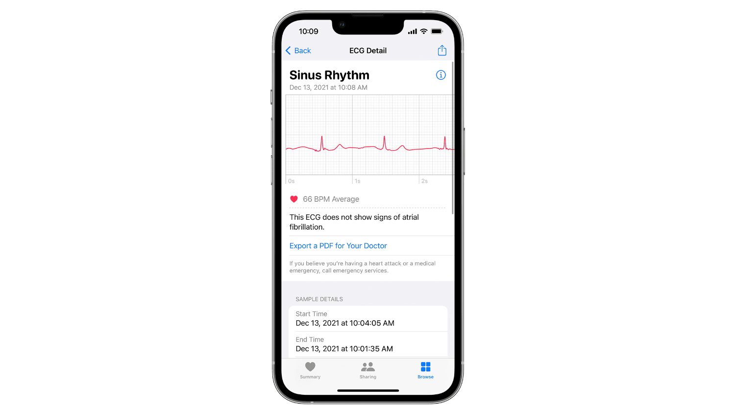 iphone does apple watch track ecg