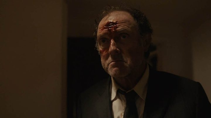 Uncle George from Servant on Apple TV+ with blood on his forehead, looking dirty and disheveled.