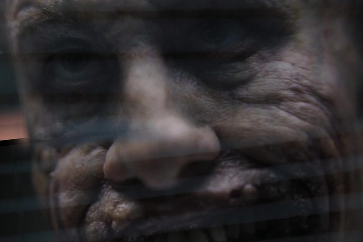 A disfigured man smiles into a window.