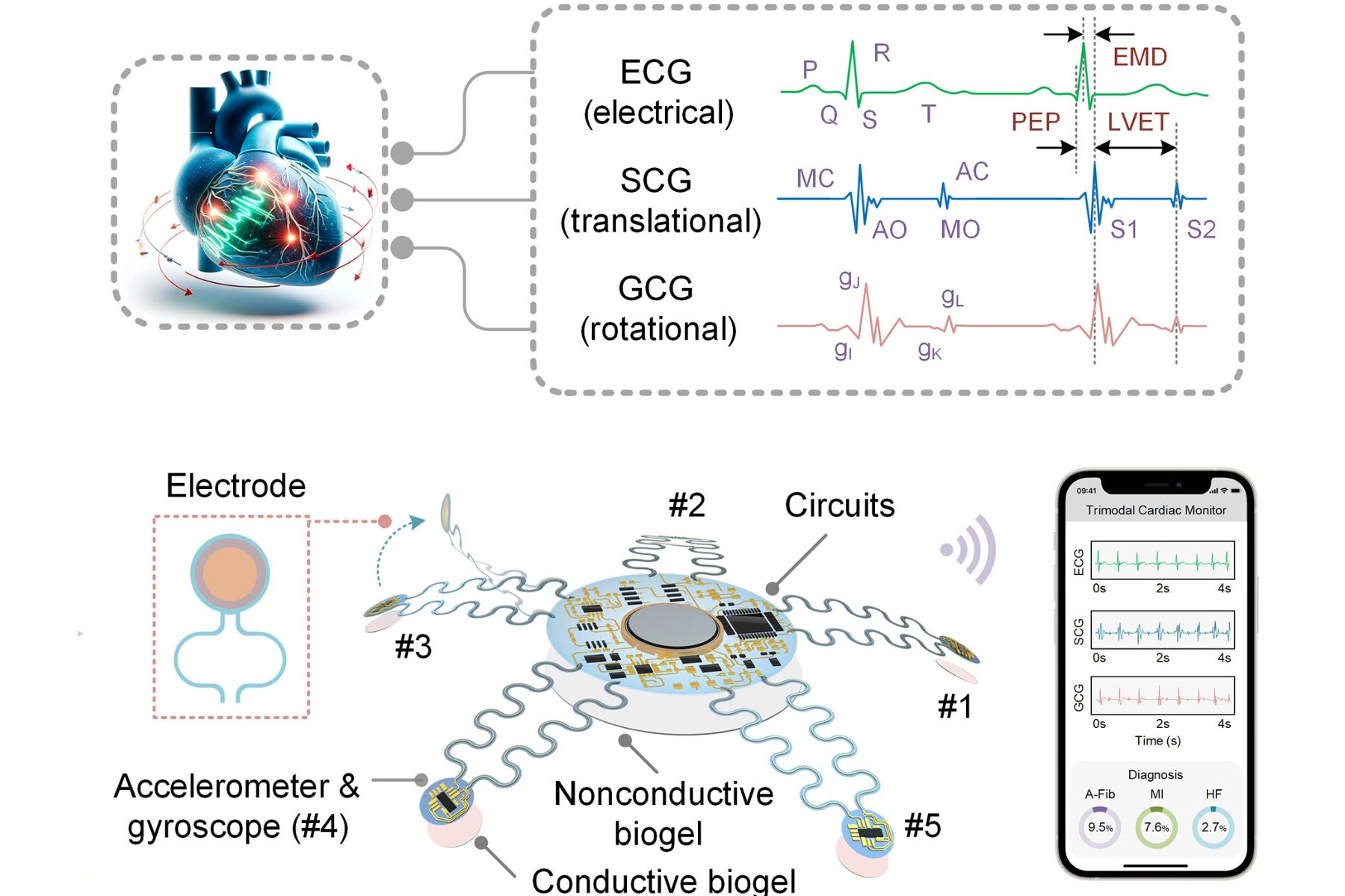 Schematic of Starfish-inspired heart-rate sensor.