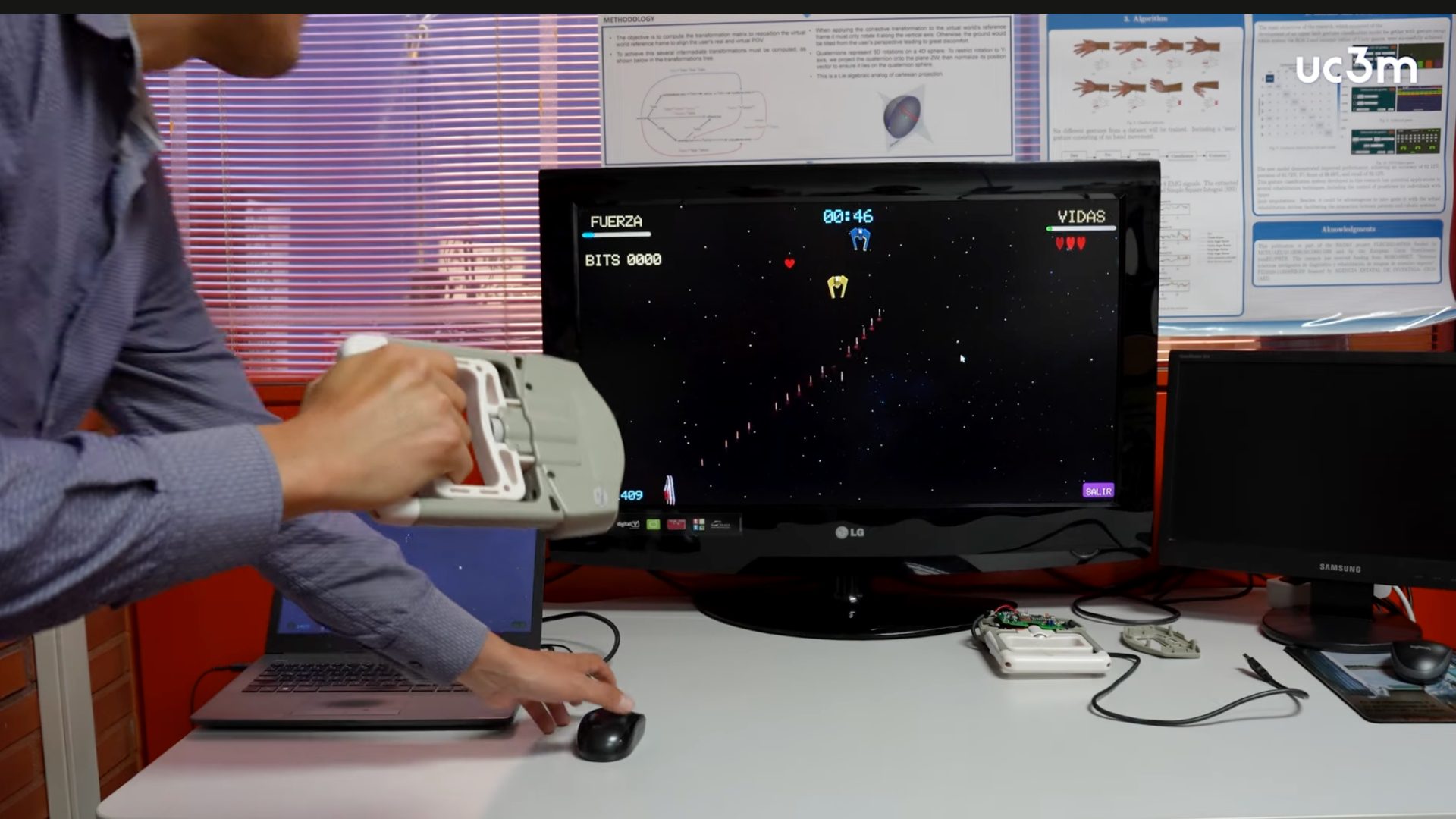 eJamar game controller usage for rehabilitation.
