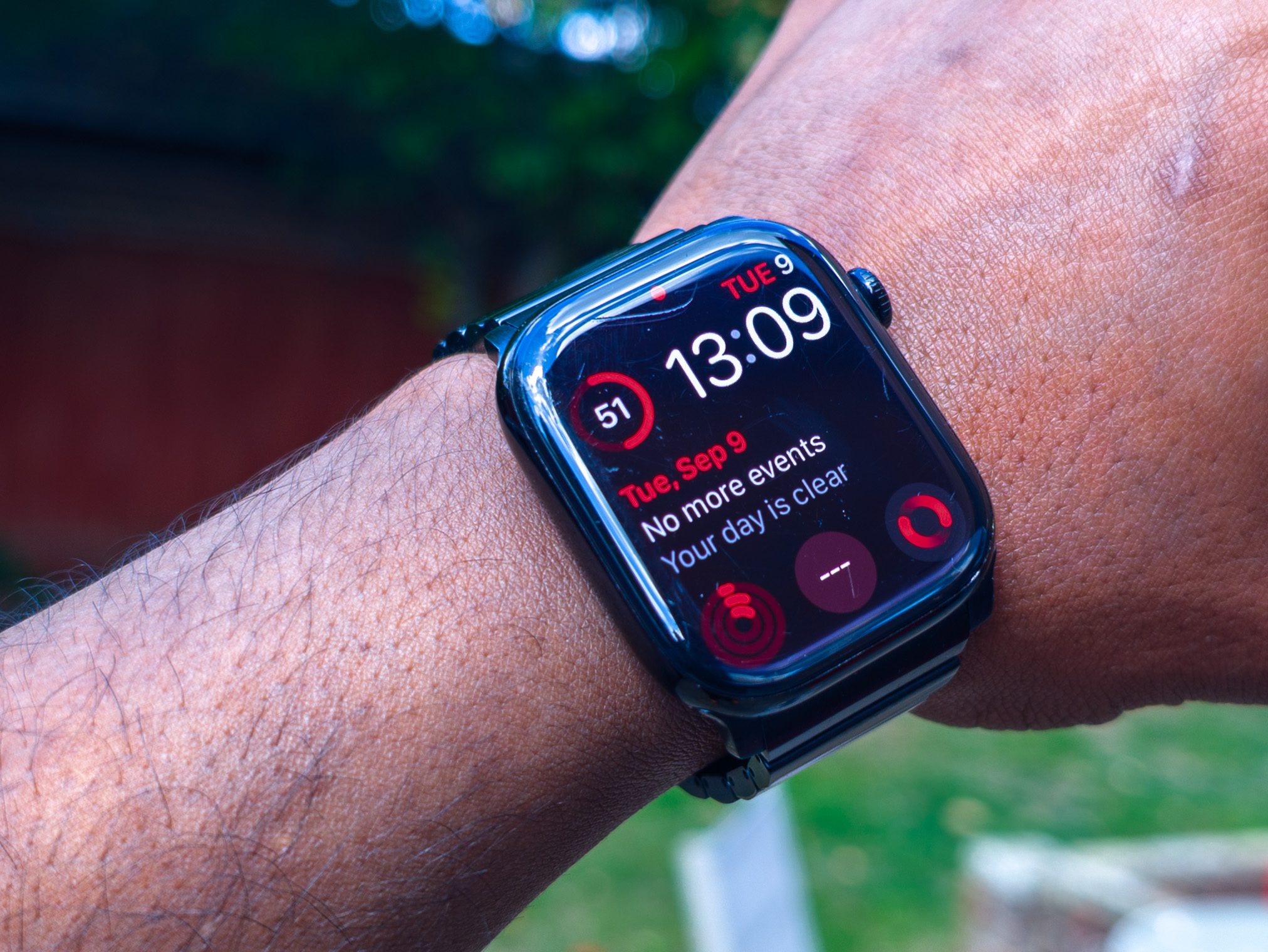 Scratches and damage on the Apple Watch 10 display and aluminum casing after a year