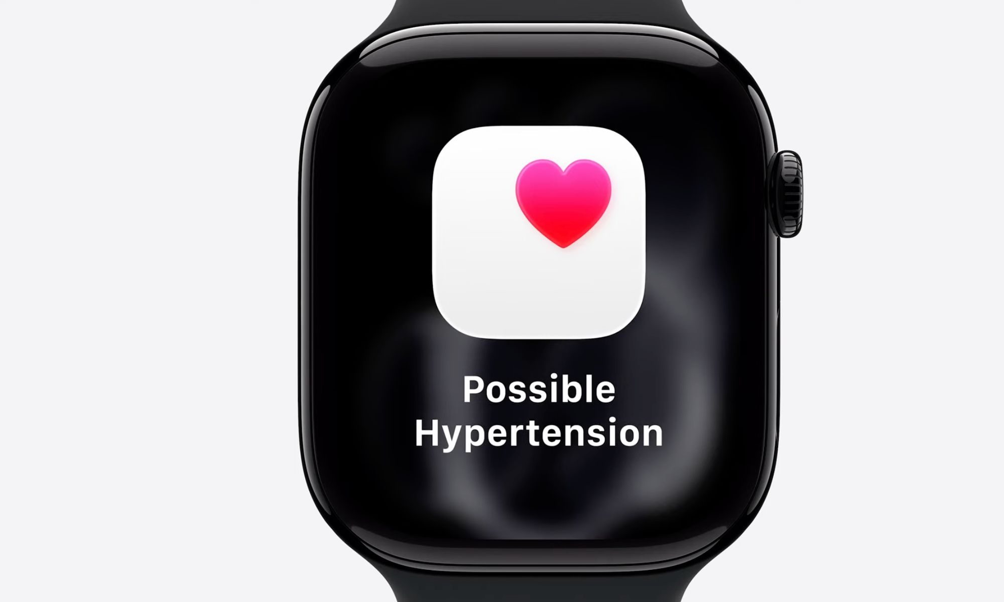 Apple Watch Series 11.