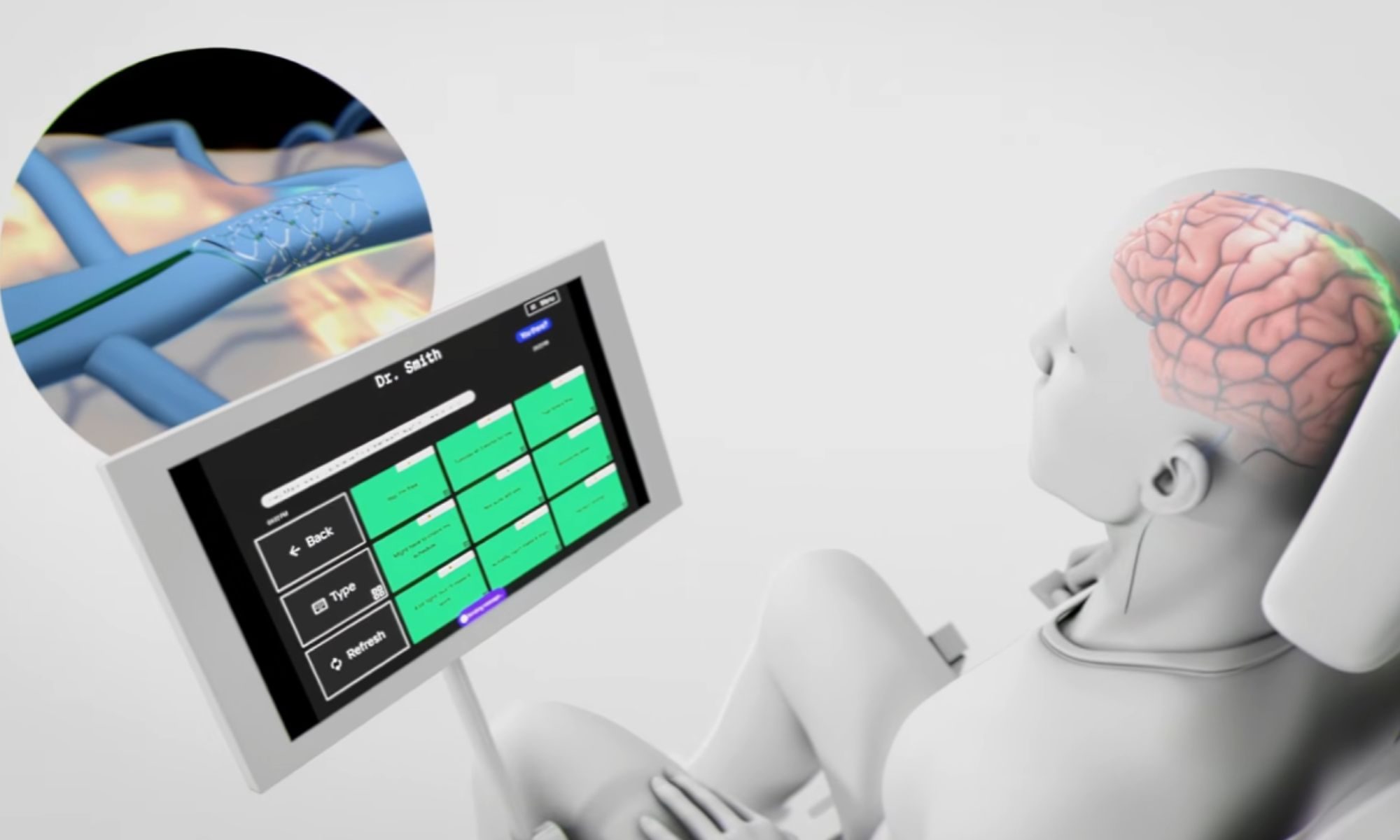 Chinese startup claims its brain implant takes just 10 minutes to place, no skull surgery required  www.digitaltrends.com