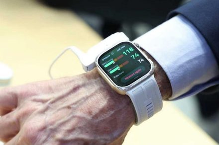 A smartwatch that measures real blood pressure level is around the corner, and it doesn’t look goofy