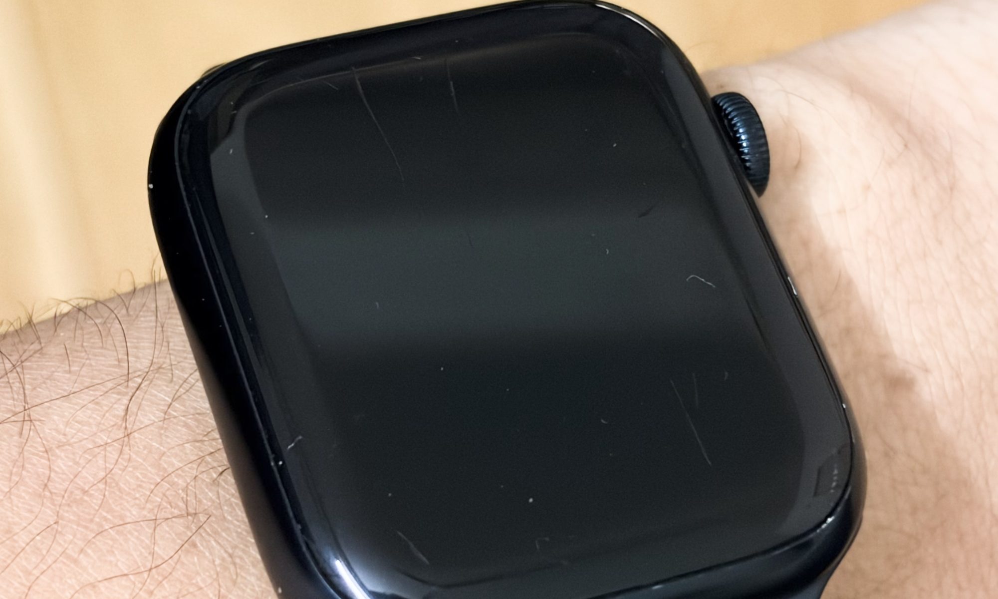 Scractches on my Apple Watch Series 8