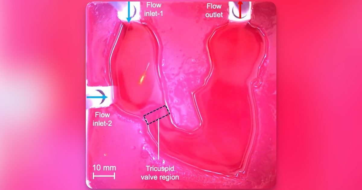 Rice-sized robots aim to shorten heart infection treatment