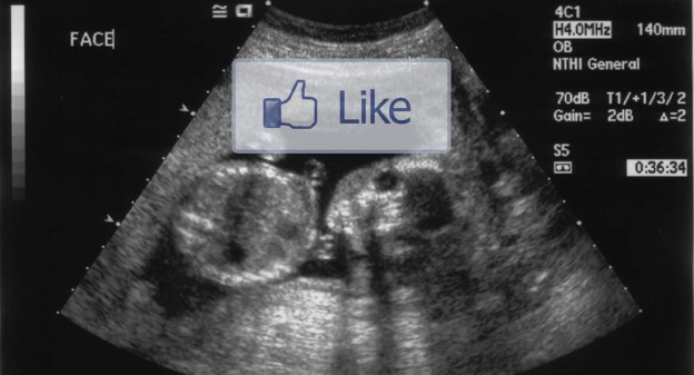 ultrasound2-fb-like
