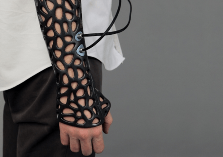 osteoid 3d printed cast uses ultrasound heal bones 40 faster screen shot 2014 04 18 at 11 23 08 am