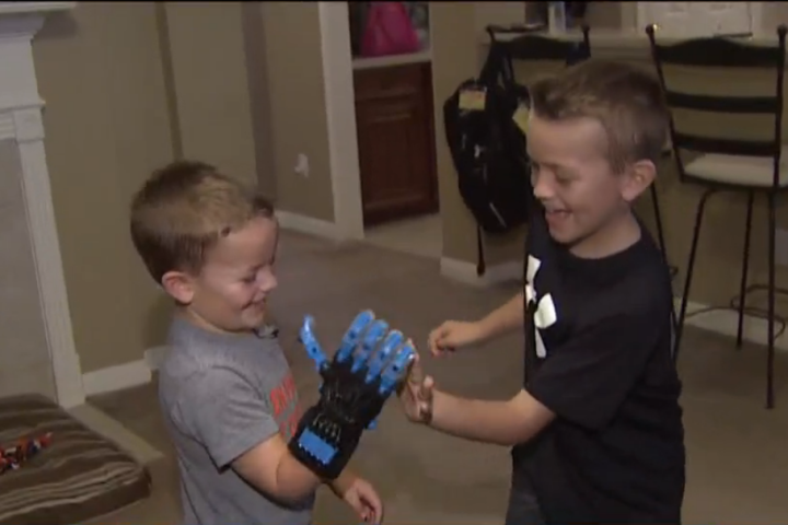Boy 3D printed hand