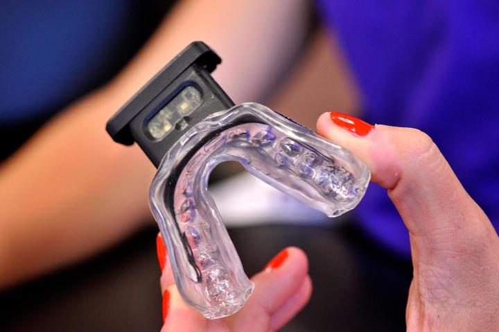 A high-tech mouthguard from i1 Biometrics may solve the riddle of football concussions.