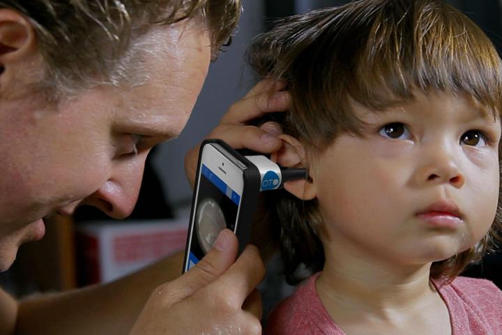 oto smartphone attachment diagnose ear infections otoscope app