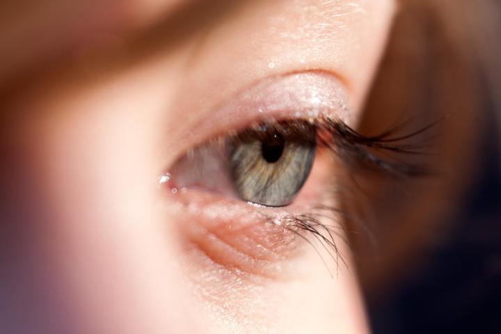 get rid of cataracts with eye drops thanks to new research izzyeye1