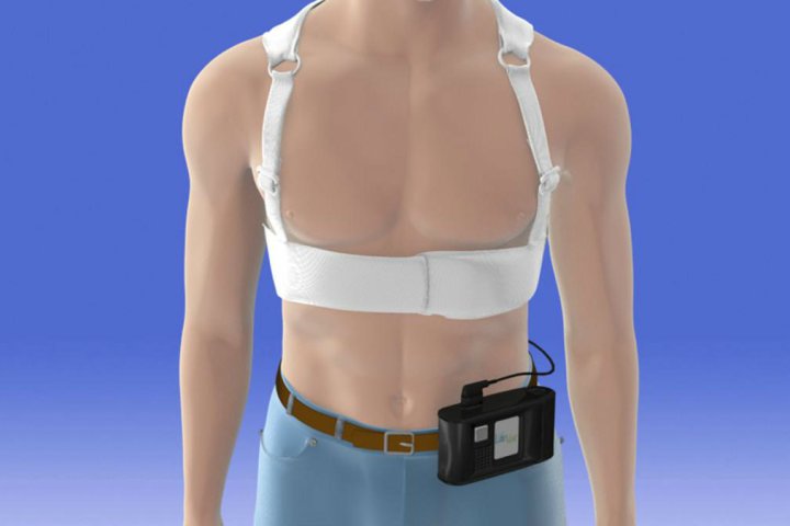 LifeVest, defibrillator