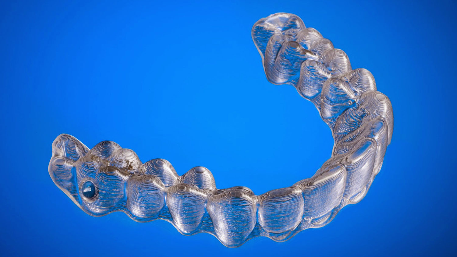 DIYer Straightens Teeth Using 3D-Printed Invisalign Braces | Digital ...