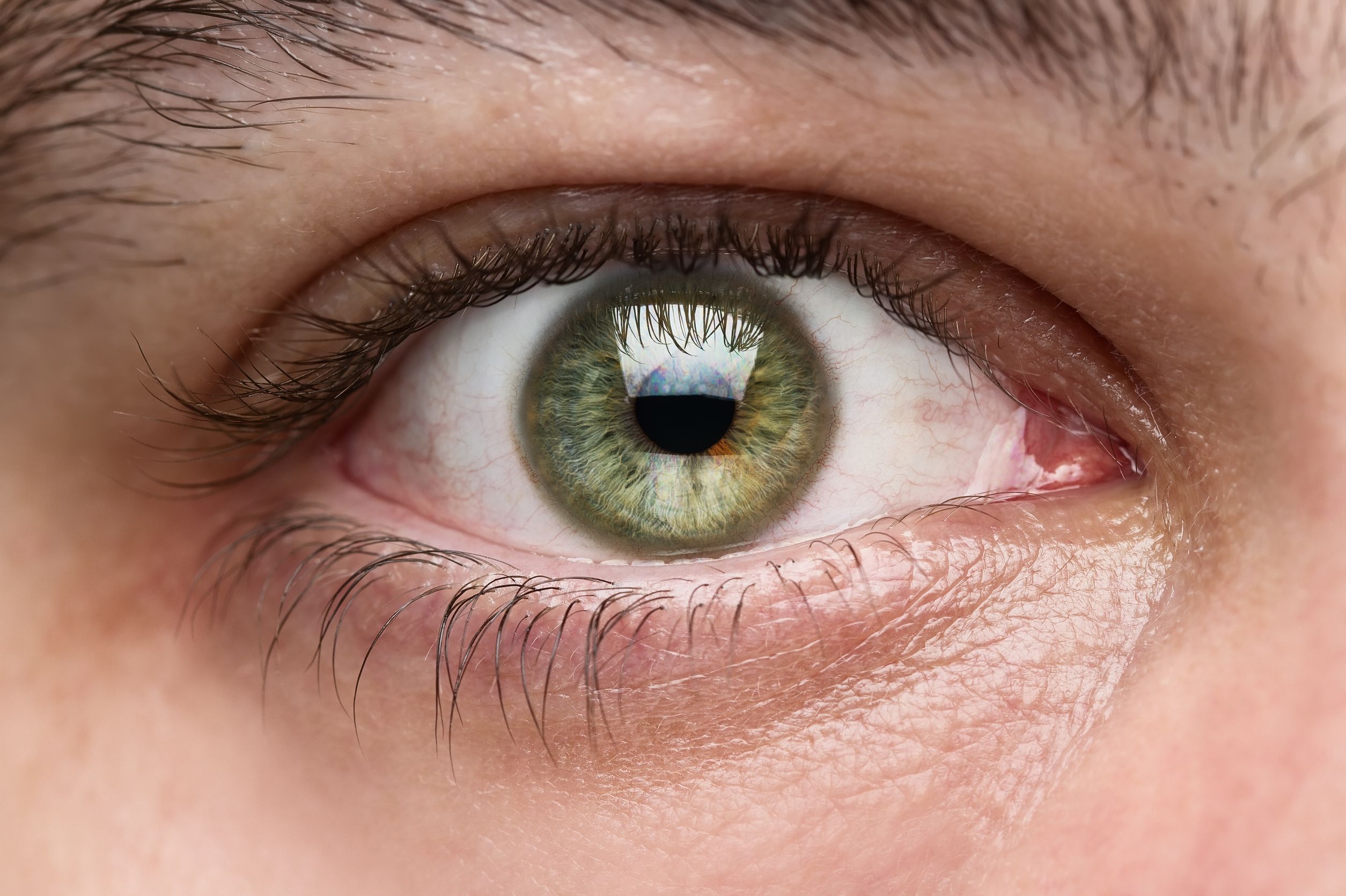 Eye Emergencies - Symptoms and Causes
