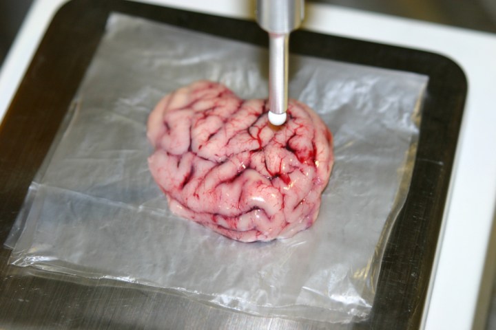 Smart scalpel tested in pig brain cancer detection tool