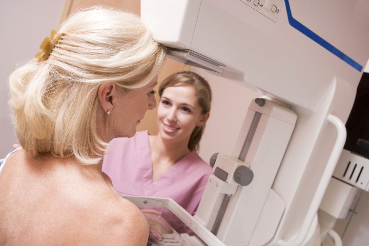 ai breast cancer mammogram 0001