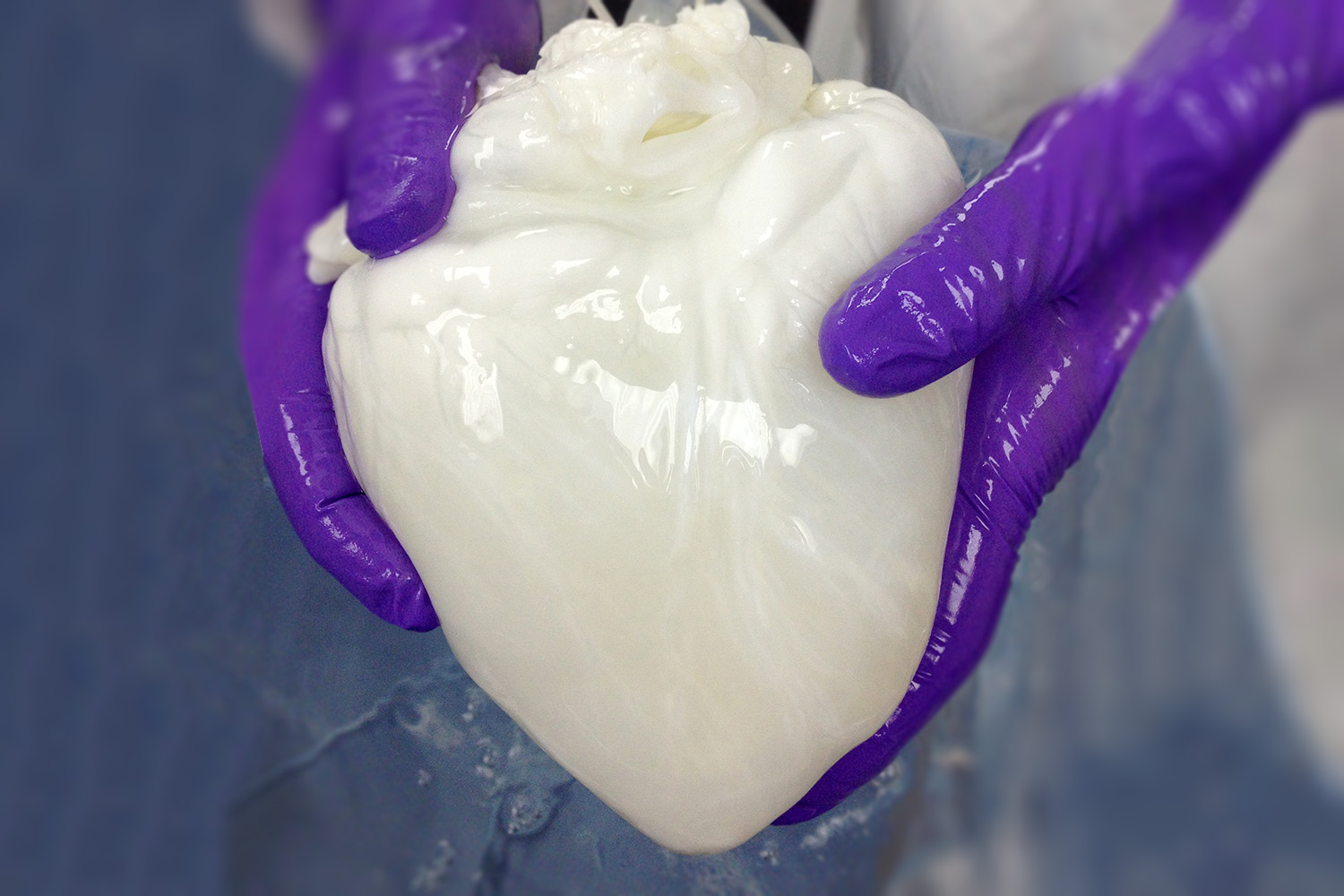 organ transplant micomatrix medical heart digital extension