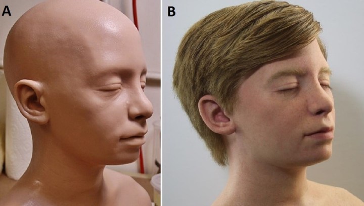 Realistic 3D-Printed Model Helps Train Medical Students to Perform Brain  Surgery | Digital Trends