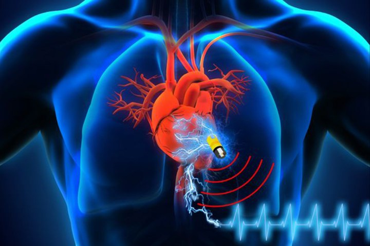 medical devices at risk of hacking pacemaker