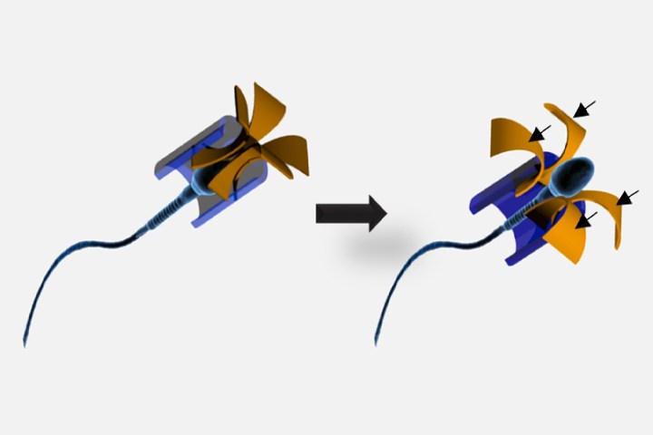 cancer magnet guided sperm