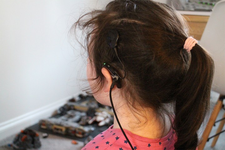 girl with cochlear implants