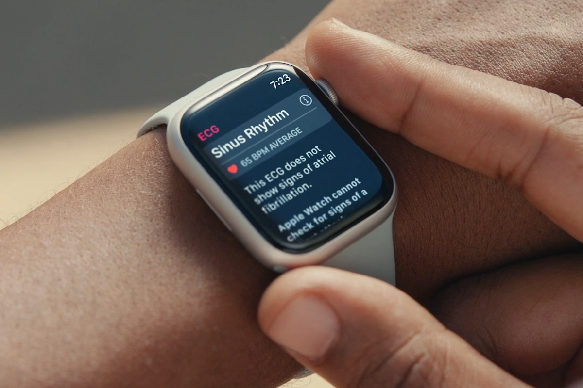 Apple Watches Are on Sale at 's October Prime Day