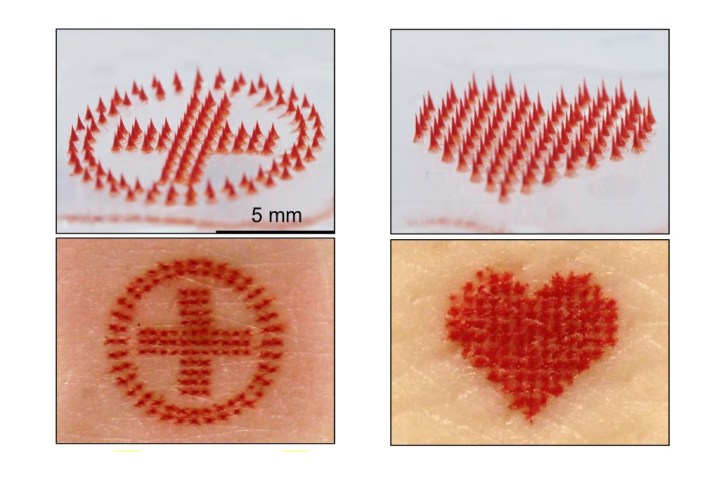 Tattoos created by microneedle technology.