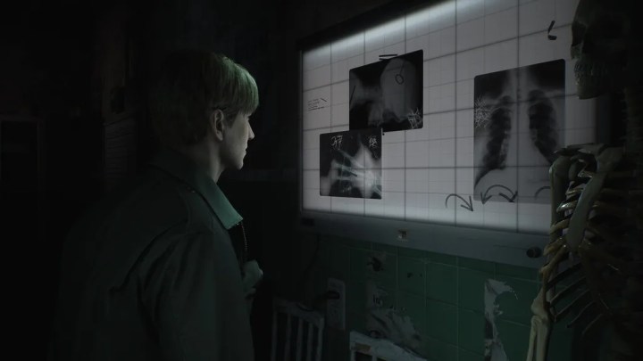 James looking at X-rays.