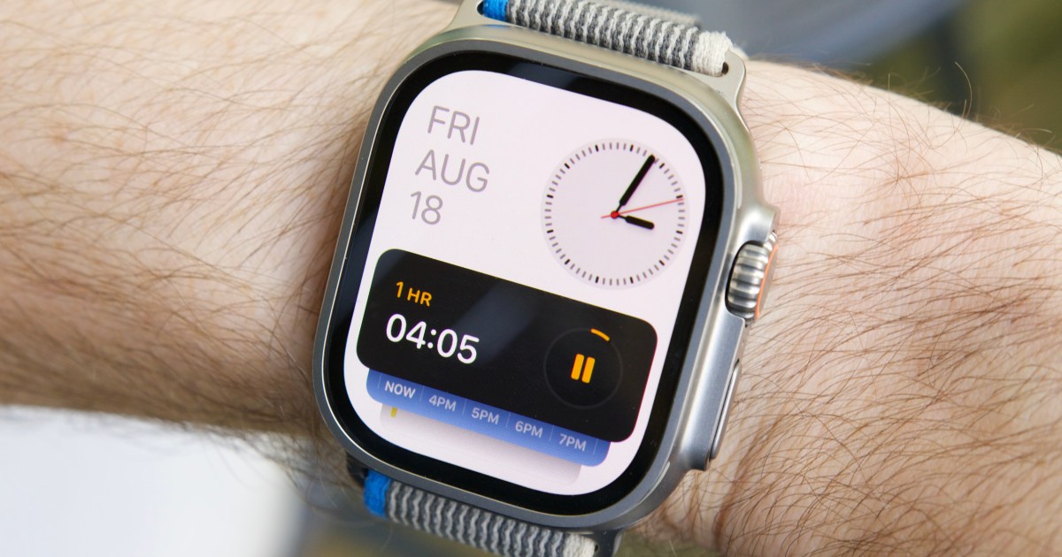The Apple Watch X could possibly be big. Listed below are 6 issues I wish to see