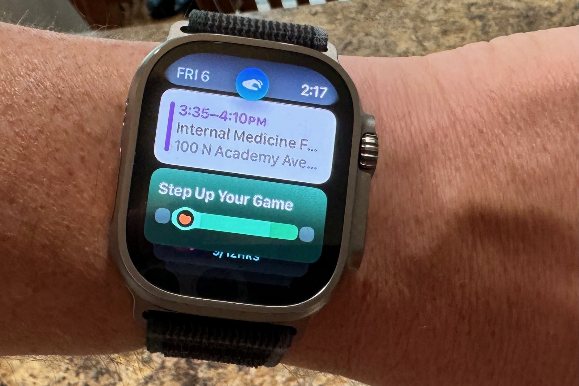 I tried Double Tap on my Apple Watch. Here's why I love it - Vimarsana News